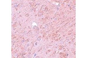 Immunohistochemical staining of rat brain tissue with PIAS4 polyclonal antibody  at 5 ug/mL dilution.