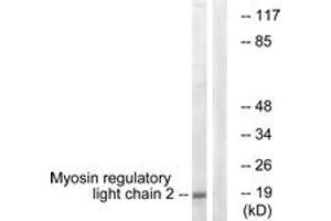 Western blot analysis of extracts from COLO205 cells, using MRLC2 (Ab-18) Antibody. (MYL12B 抗体  (AA 3-52))