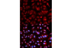 Immunofluorescence analysis of U2OS cells using PSMB5 antibody (ABIN5971025). (PSMB5 抗体)