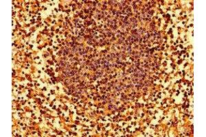 Immunohistochemistry of paraffin-embedded human lymph node tissue using ABIN7155571 at dilution of 1:100