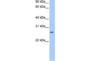 WB Suggested Anti-CRISP1 Antibody Titration: 0. (CRISP1 抗体  (N-Term))