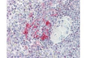 IHC-P Image LITAF antibody [N1C3] detects LITAF protein at cytoplasm on human placenta by immunohistochemical analysis. (LITAF 抗体)