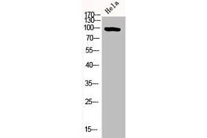 Western Blot analysis of HELA cells using Phospho-PKD2 (S876) Polyclonal Antibody (PKD2 抗体  (pSer876))