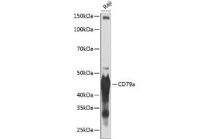 Western blot analysis of extracts of Raji cells, using CD79a antibody (ABIN7265805) at 1:1000 dilution. (CD79a 抗体)