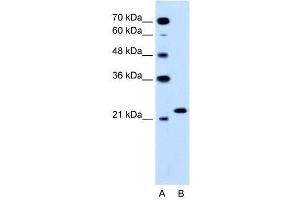 RAB14 antibody (70R-10565) used at 1. (RAB14 抗体  (C-Term))