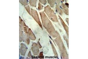 Immunohistochemistry (IHC) image for anti-Creatine Kinase, Muscle (CKM) antibody (ABIN3002974) (CKM 抗体)