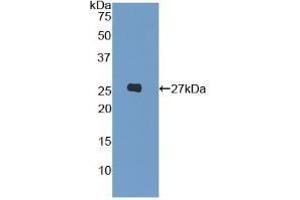 Detection of Recombinant LILRA3, Human using Polyclonal Antibody to Leukocyte Immunoglobulin Like Receptor Subfamily A, Member 3 (LILRA3)
