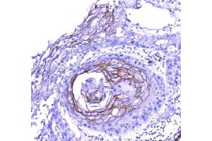 IHC analysis of Periplakin using anti-Periplakin antibody (ABIN5518787).