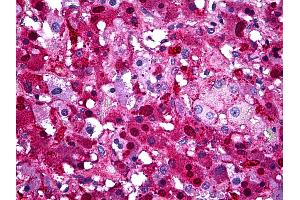 Anti-SERPINA3 antibody IHC of human adrenal.