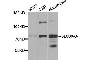 Western blot analysis of extracts of various cell lines, using SLC39A4 antibody.