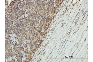 Immunostaining (ISt) image for anti-Enolase 1 (ENO1) (AA 1-434) antibody (ABIN560741)