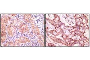 Immunohistochemistry (IHC) image for anti-Synuclein, gamma (Breast Cancer-Specific Protein 1) (SNCG) antibody (ABIN1845097) (SNCG 抗体)