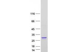 Western Blotting (WB) image for ADP Ribosylation Factor Like GTPase 6 (ARL6) (Transcript Variant 1) protein (Myc-DYKDDDDK Tag) (ABIN2714914)