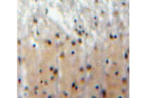 Used in DAB staining on fromalin fixed paraffin-embedded brain tissue (FBXW7 抗体  (AA 312-545))