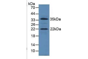 SDS-PAGE of Protein Standard from the Kit  (Highly purified E. (IGF1 ELISA 试剂盒)