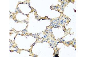 Immunohistochemistry (Paraffin-embedded Sections) (IHC (p)) image for anti-Prolactin-Induced Protein (PIP) antibody (ABIN7262206)