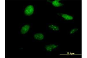 Immunofluorescence of purified MaxPab antibody to NKX2-8 on HeLa cell. (NKX2-8 抗体  (AA 1-239))