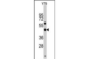 Western blot analysis of TGIF1 polyclonal antibody  in Y-79 cell line lysates (35 ug/lane). (TGIF1 抗体  (Internal Region))