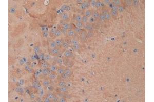 Detection of DNM1 in Mouse Brain Tissue using Polyclonal Antibody to Dynamin 1 (DNM1) (Dynamin 1 抗体  (AA 572-745))