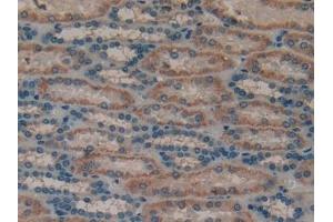 Detection of MUC1 in Human Kidney Tissue using Polyclonal Antibody to Mucin 1 (MUC1) (MUC1 抗体  (AA 1098-1255))