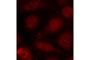 Immunofluorescence analysis of methanol-fixed MCF-7 cells using Phospho-PRKCB-T641 antibody (ABIN3019760, ABIN3019761, ABIN3019762, ABIN1681948 and ABIN1681949). (PRKCA/PRKCB (pThr638), (pThr641) 抗体)