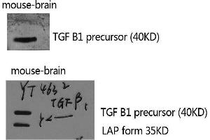 Western Blotting (WB) image for anti-Transforming Growth Factor, beta 1 (TGFB1) (C-Term) antibody (ABIN3187249) (TGFB1 抗体  (C-Term))