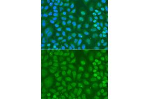 Immunofluorescence (IF) image for anti-CXXC Finger Protein 1 (CXXC1) antibody (ABIN2562080)