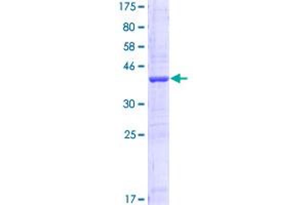 AKR1C2 Protein (AA 224-323) (GST tag)