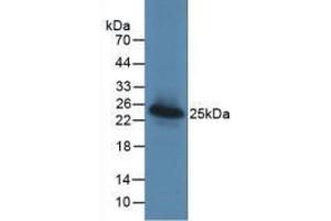 Western Blot; Sample: Recombinant LGALS3BP, Human. (LGALS3BP 抗体  (AA 24-221))