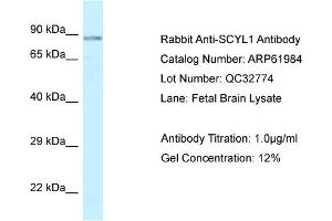 Western Blotting (WB) image for anti-SCY1-Like 1 (SCYL1) (C-Term) antibody (ABIN2788975) (SCYL1 抗体  (C-Term))