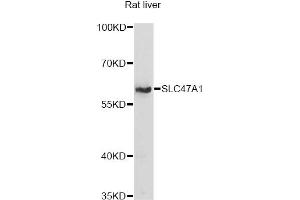 Western blot analysis of extracts of rat liver, using SLC47A1 antibody (ABIN6292279) at 1:1000 dilution. (SLC47A1 抗体)
