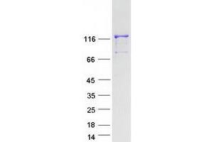 Validation with Western Blot