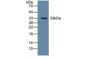 Figure. (DDR1 抗体  (AA 568-829))