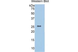 Western Blotting (WB) image for N-Acetylgalactosaminidase, alpha (NAGA) ELISA Kit (ABIN6720593)