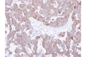 TCP1 theta Antibody staining of paraffin-embedded OVCAR3 xenograft at 1/500 dilution. (CCT8 抗体  (AA 111-327))