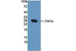 Western Blotting (WB) image for anti-Protein Tyrosine Phosphatase Type IVA, Member 3 (PTP4A3) (AA 1-170) antibody (ABIN7435550)
