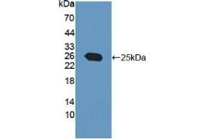 Detection of Recombinant PTP4A3, Human using Polyclonal Antibody to Protein Tyrosine Phosphatase Type IVA 3 (PTP4A3) (PTP4A3 抗体  (AA 1-170))