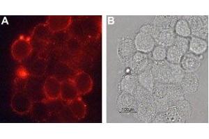 Immunocytochemistry (ICC) image for anti-Solute Carrier Family 6 (Neurotransmitter Transporter, Dopamine), Member 3 (SLC6A3) (AA 191-205), (Extracellular) antibody (ABIN7043740)
