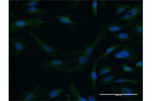 Immunofluorescence of purified MaxPab antibody to DTNA on HeLa cell.