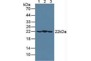 Western blot analysis of (1) Mouse Brain Tissue, (2) Mouse Heart Tissue and (3) Porcine Brain Tissue. (CRYAB 抗体  (AA 1-175))