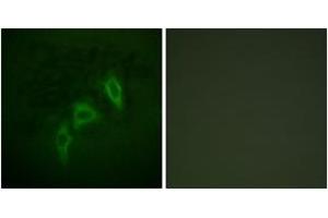 Immunofluorescence analysis of HepG2 cells, using Tuberin/TSC2 (Ab-939) Antibody. (Tuberin 抗体  (AA 905-954))
