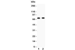 Western blot testing of Numb antibody and Lane 1: human U87 (NUMB 抗体  (AA 194-220))