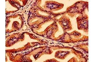 Immunohistochemistry of paraffin-embedded human prostate tissue using ABIN7174184 at dilution of 1:100