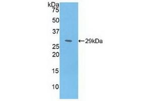 Detection of Recombinant MAT2a, Human using Polyclonal Antibody to Methionine Adenosyltransferase II Alpha (MAT2a) (MAT2A 抗体  (AA 176-395))