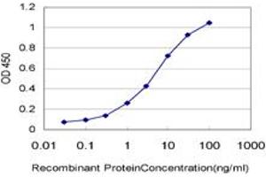 Detection limit for recombinant GST tagged DTX3L is approximately 0. (DTX3L 抗体  (AA 3-110))