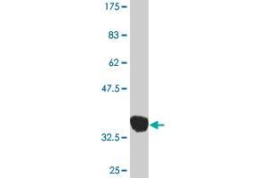 Western Blot detection against Immunogen (36. (MAP2K3 抗体  (AA 1-100))