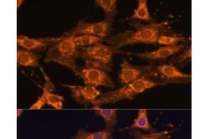 Immunofluorescence analysis of C6 cells using UBQLNL Polyclonal Antibody at dilution of 1:100. (UBQLNL 抗体)
