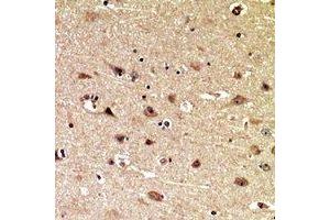 Immunohistochemical analysis of MIB1 staining in human brain formalin fixed paraffin embedded tissue section. (MIB1 抗体  (C-Term))