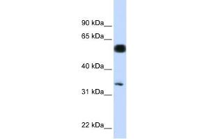 C19ORF62 antibody used at 1 ug/ml to detect target protein. (BRISC and BRCA1 A Complex Member 1 (BABAM1) (N-Term) 抗体)