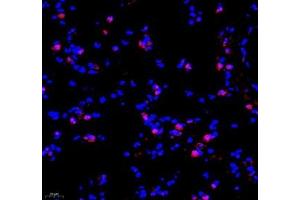 Immunofluorescence of paraffin embedded mouse lung using TEAD3 (ABIN7075852) at dilution of 1: 700 (400x lens) (TEAD3 抗体)